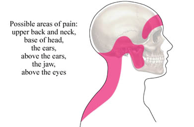 Headache Relief Valrico Fishhawk Bloomingdale Riverview